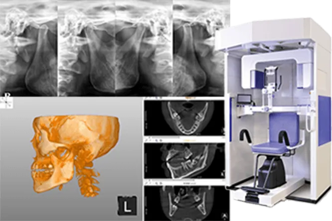 歯科用CT